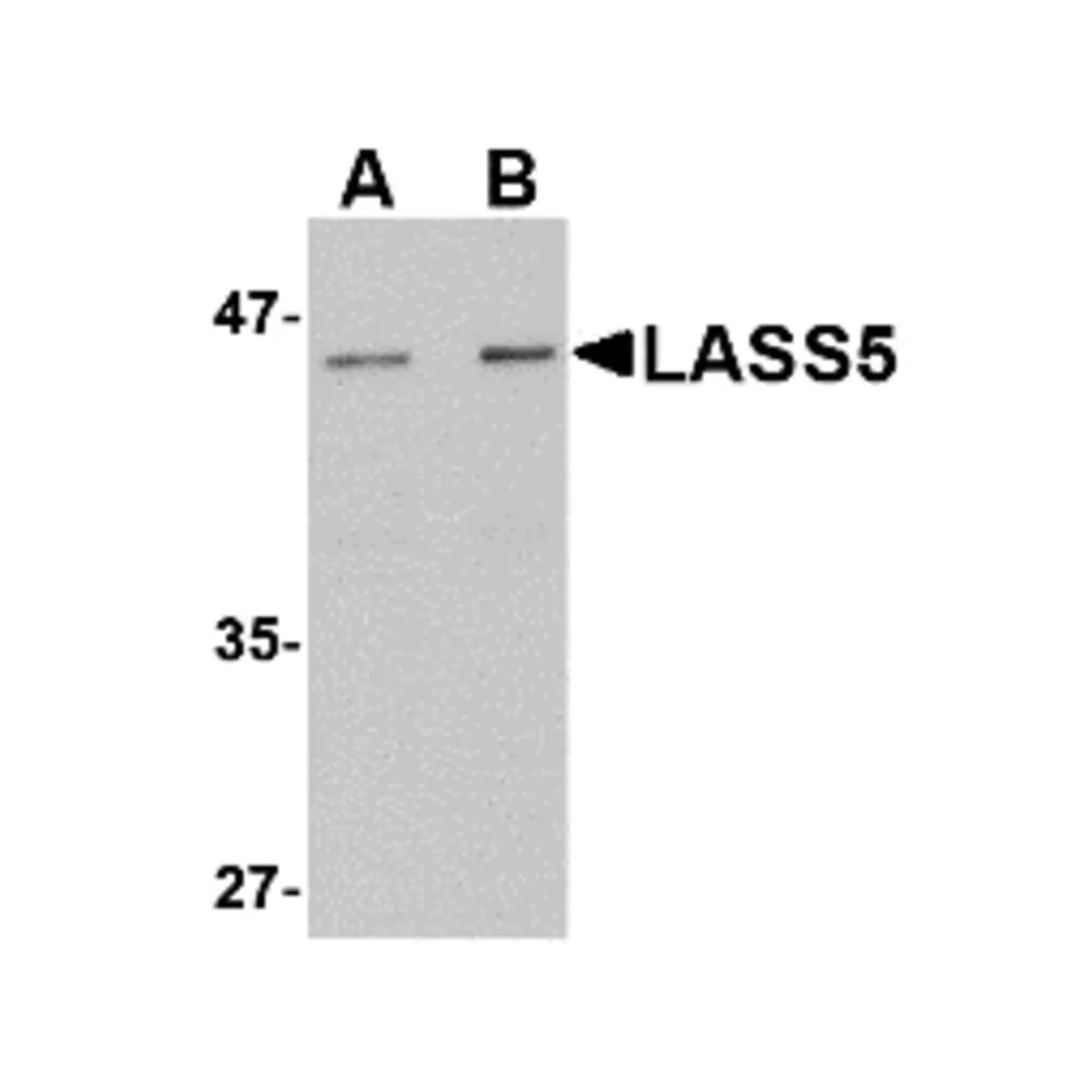 ProSci 4697 LASS5 Antibody, ProSci, 0.1 mg/Unit Primary Image
