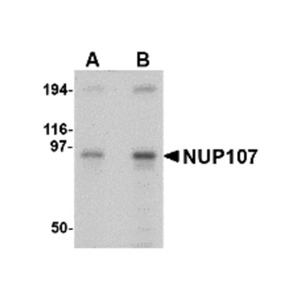 ProSci 4699 NUP107 Antibody, ProSci, 0.1 mg/Unit Primary Image