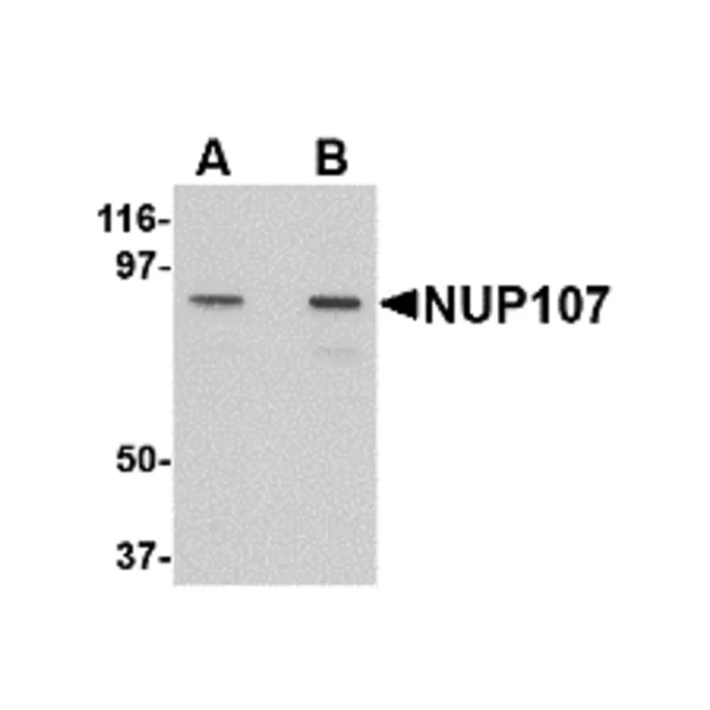 ProSci 4701_S NUP107 Antibody, ProSci, 0.02 mg/Unit Primary Image