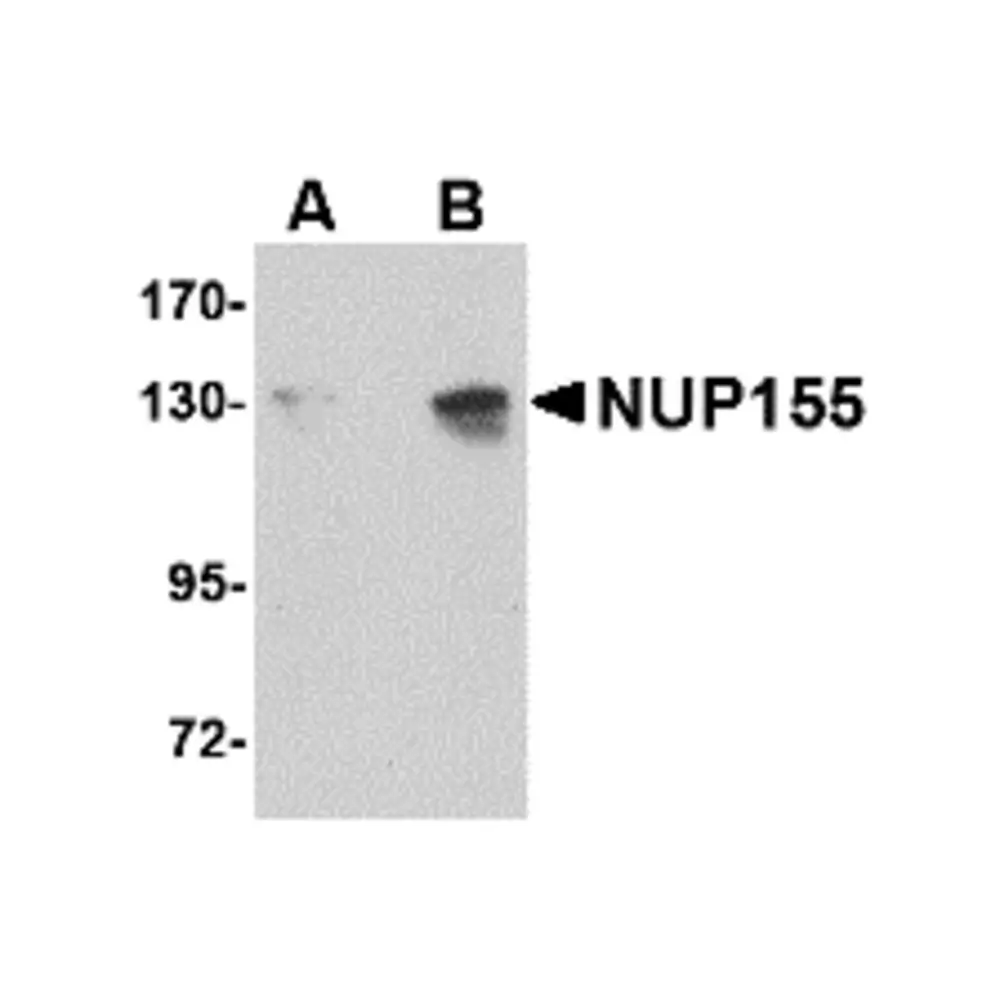 ProSci 4703 NUP155 Antibody, ProSci, 0.1 mg/Unit Primary Image