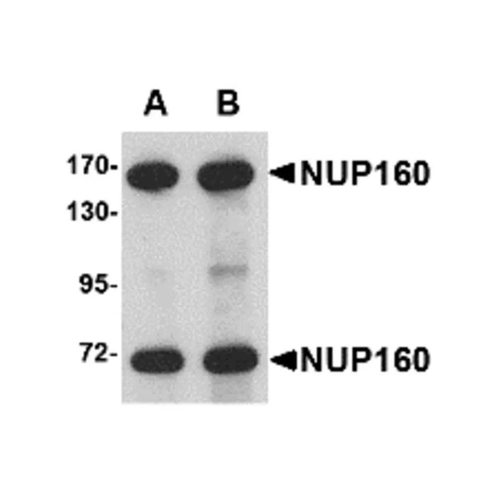 ProSci 4707_S NUP160 Antibody, ProSci, 0.02 mg/Unit Primary Image