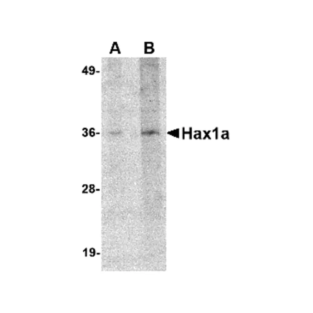 ProSci 4711_S Hax1a Antibody, ProSci, 0.02 mg/Unit Primary Image