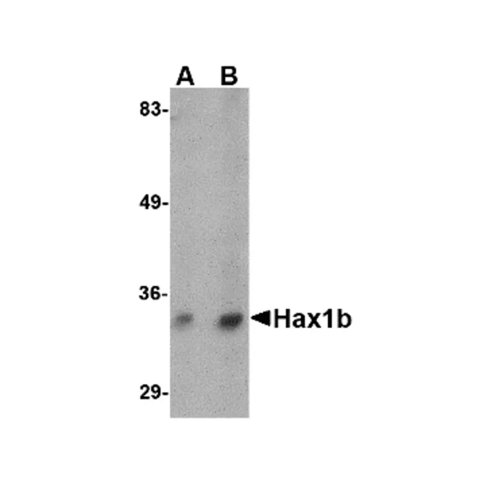 ProSci 4715 Hax1b Antibody, ProSci, 0.1 mg/Unit Primary Image