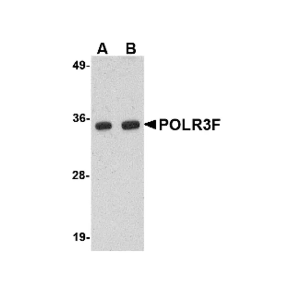 ProSci 4727 POLR3F Antibody, ProSci, 0.1 mg/Unit Primary Image