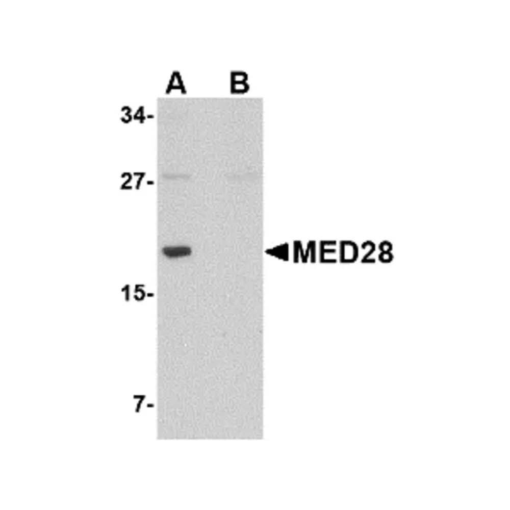 ProSci 4731_S MED28 Antibody, ProSci, 0.02 mg/Unit Primary Image