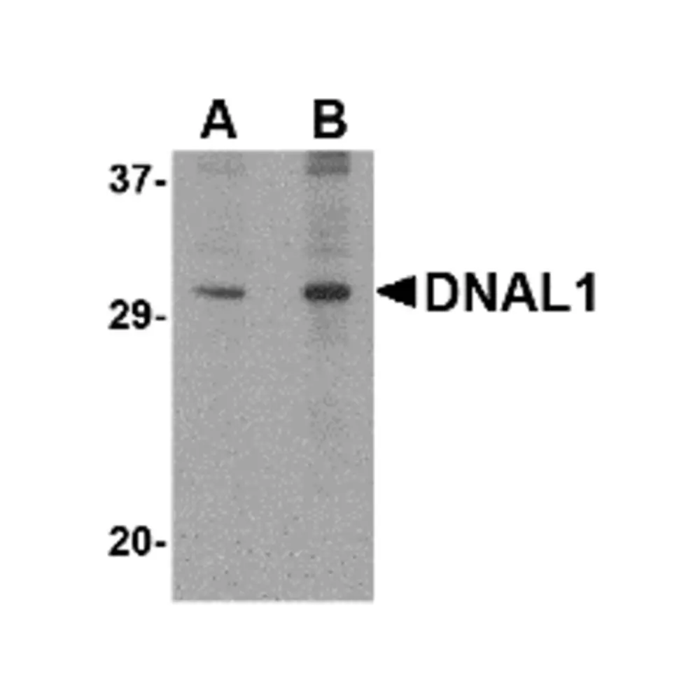ProSci 4733 DNAL1 Antibody, ProSci, 0.1 mg/Unit Primary Image