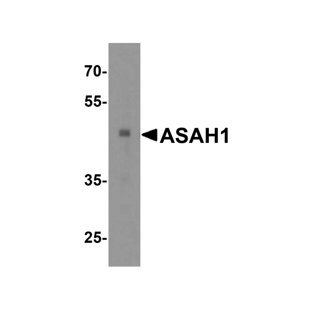 ProSci 4741_S ASAH1 Antibody, ProSci, 0.02 mg/Unit Primary Image