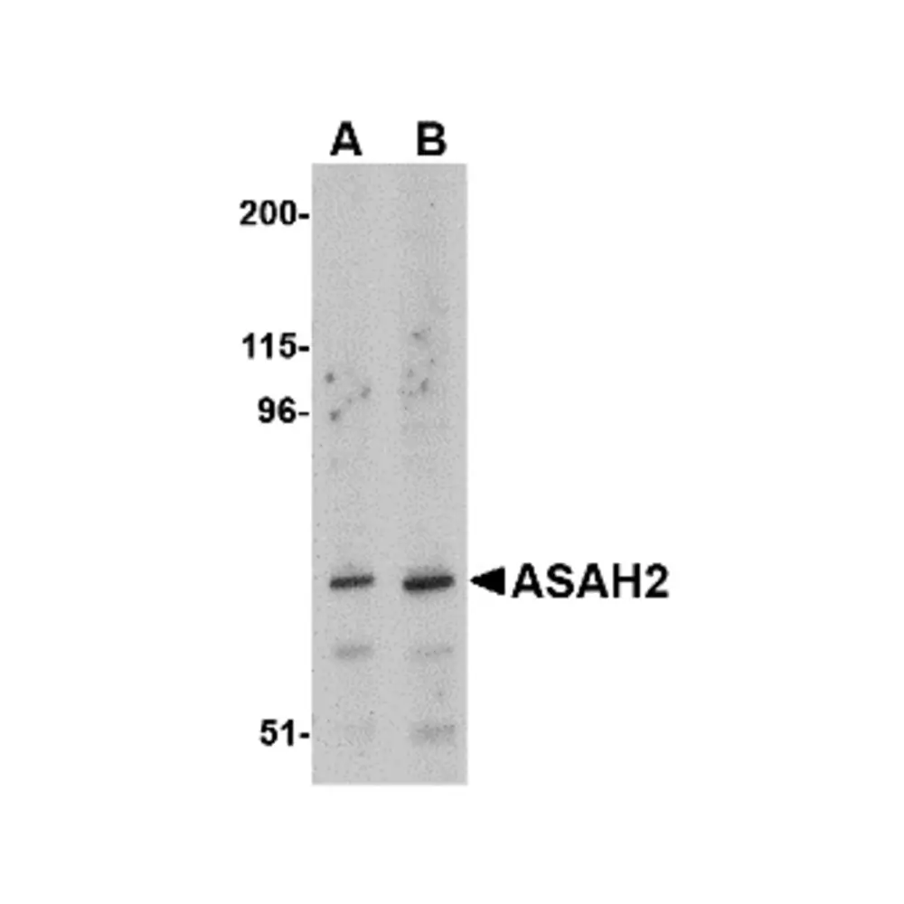 ProSci 4743_S ASAH2 Antibody, ProSci, 0.02 mg/Unit Primary Image