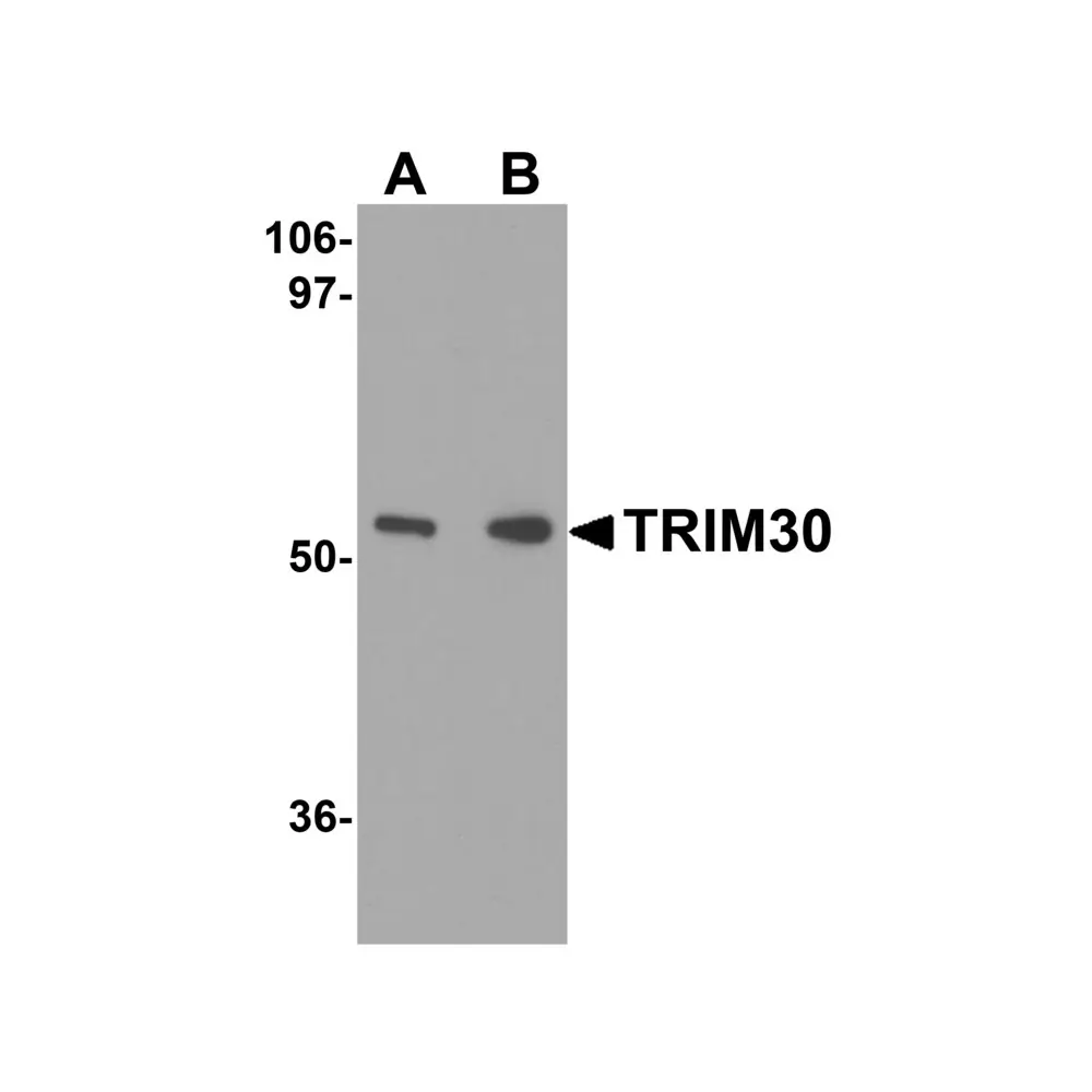 ProSci 4747_S TRIM30 Antibody, ProSci, 0.02 mg/Unit Primary Image