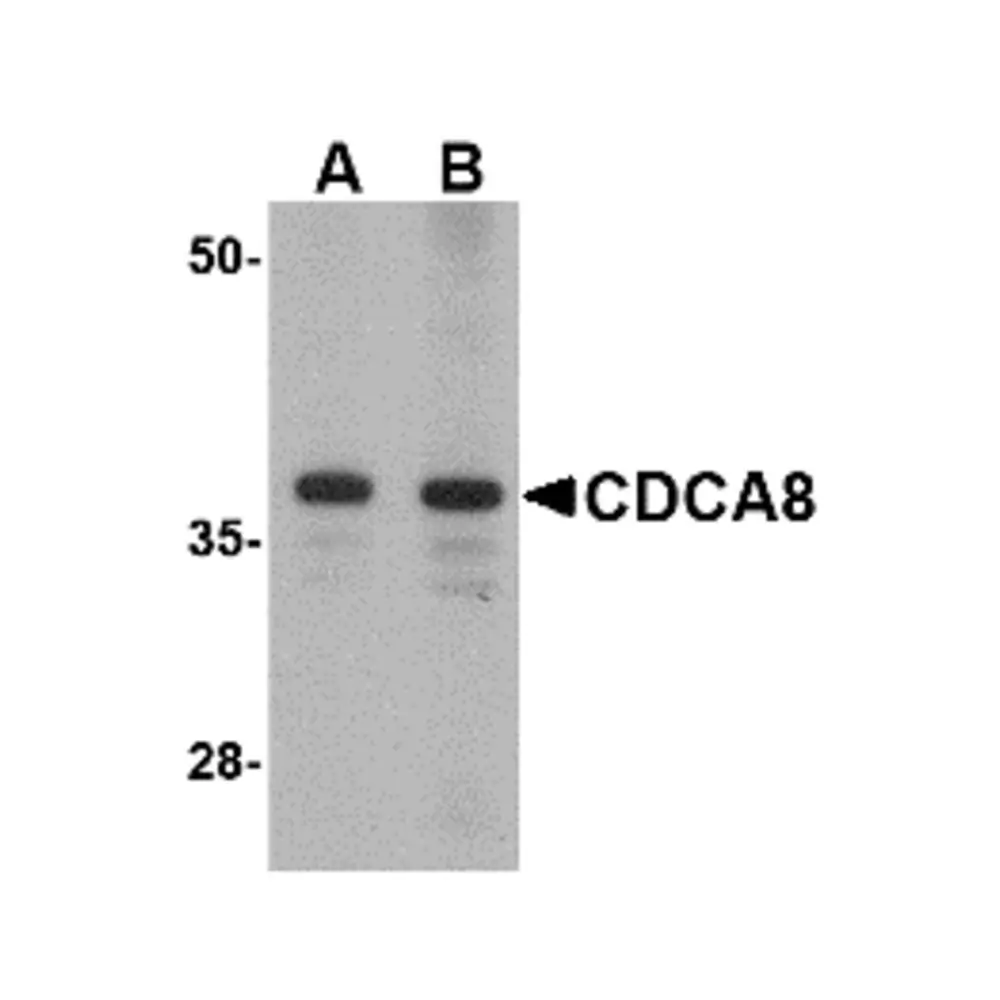 ProSci 4751_S CDCA8 Antibody, ProSci, 0.02 mg/Unit Primary Image