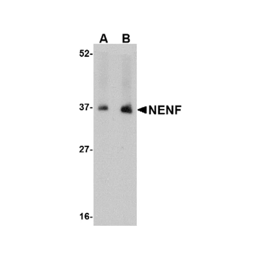 ProSci 4753 NENF Antibody, ProSci, 0.1 mg/Unit Primary Image