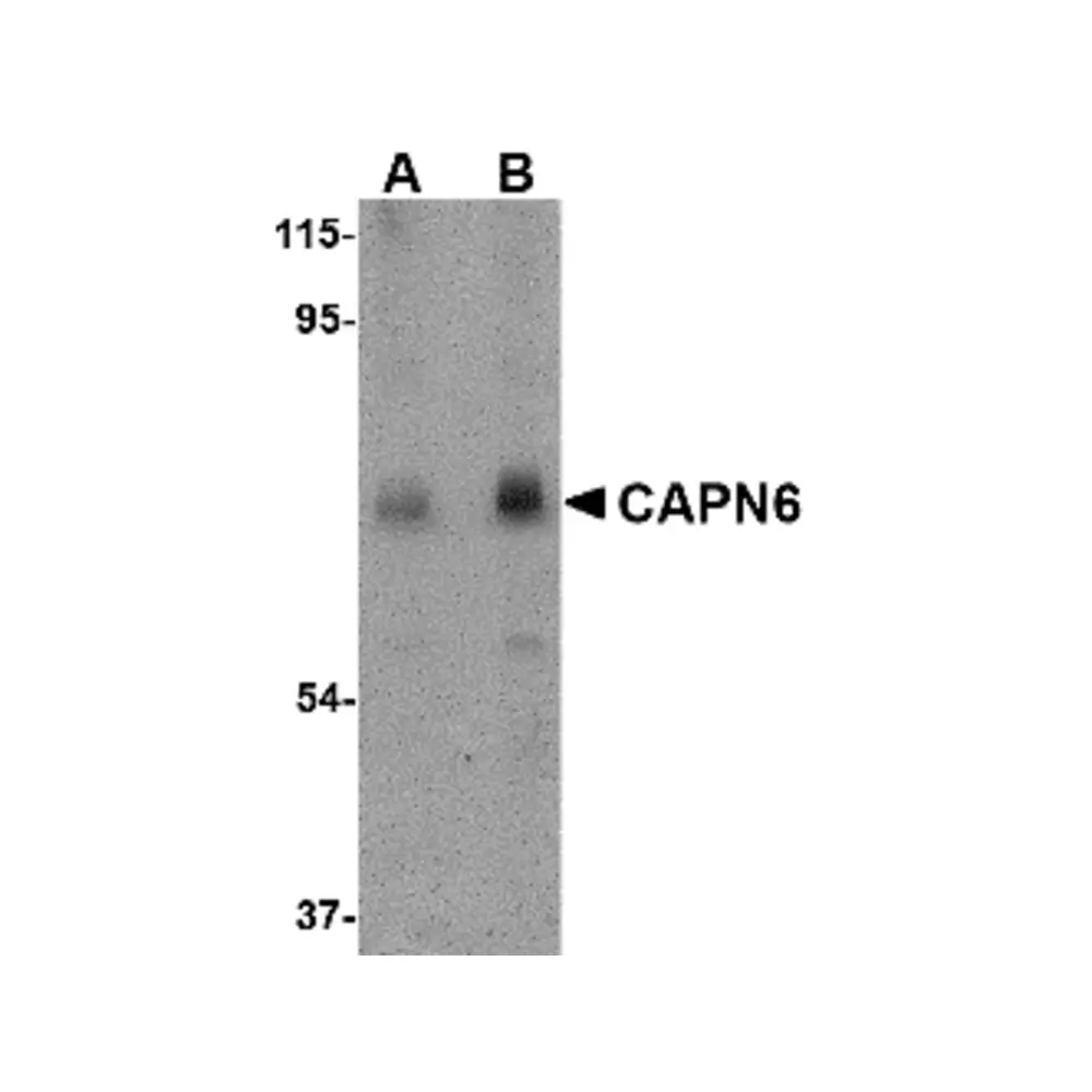 ProSci 4759 CAPN6 Antibody, ProSci, 0.1 mg/Unit Primary Image