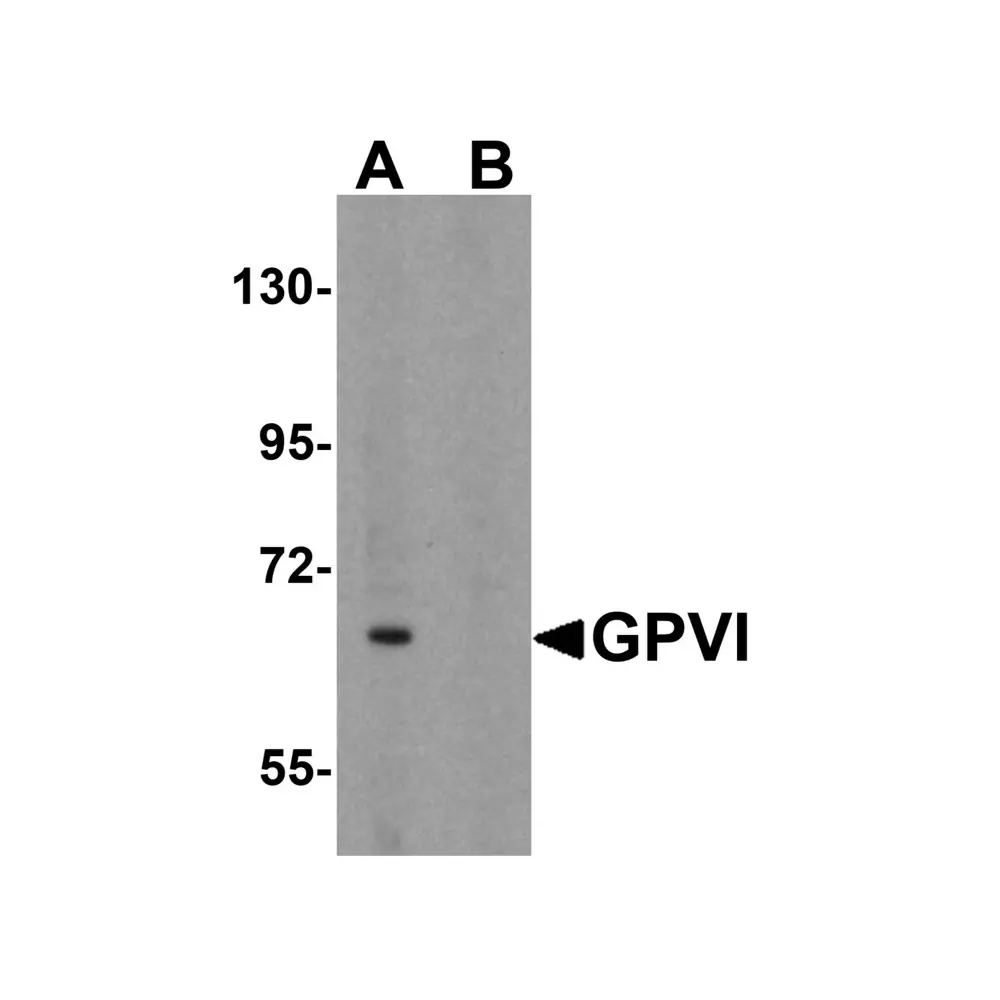 ProSci 4769 GPVI Antibody, ProSci, 0.1 mg/Unit Primary Image