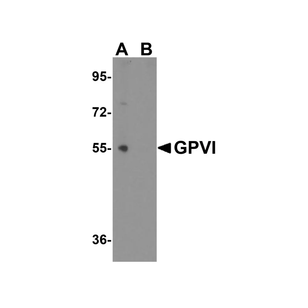 ProSci 4771_S GPVI Antibody, ProSci, 0.02 mg/Unit Primary Image