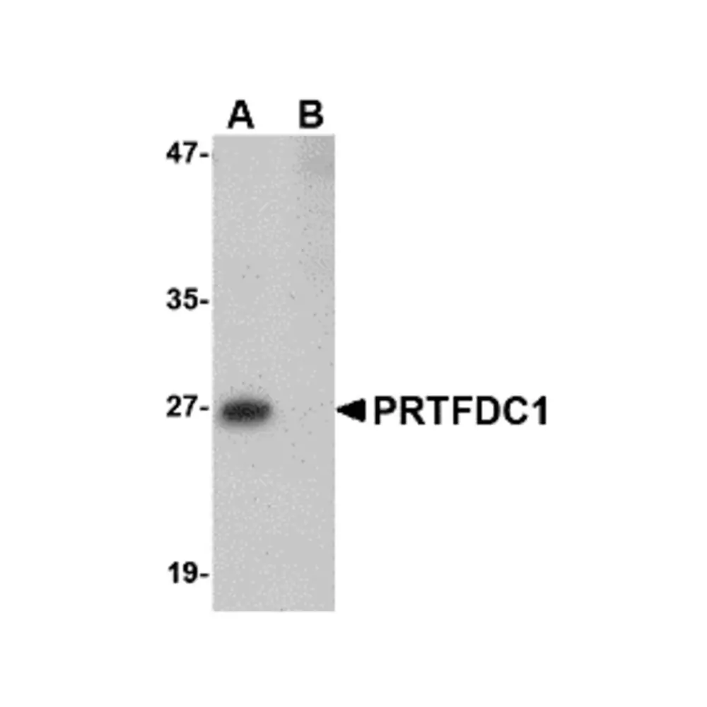 ProSci 4775 PRTFDC1 Antibody, ProSci, 0.1 mg/Unit Primary Image
