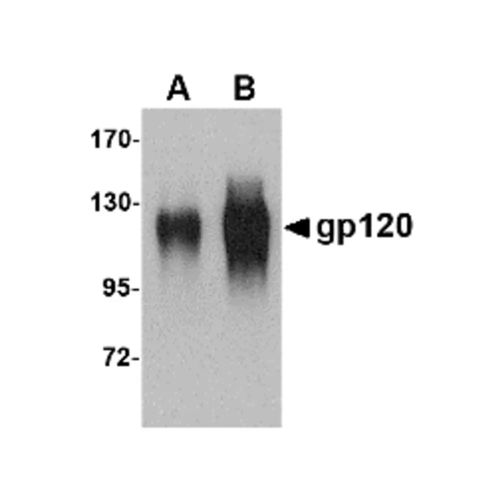 ProSci 4777 gp120 Antibody, ProSci, 0.1 mg/Unit Primary Image