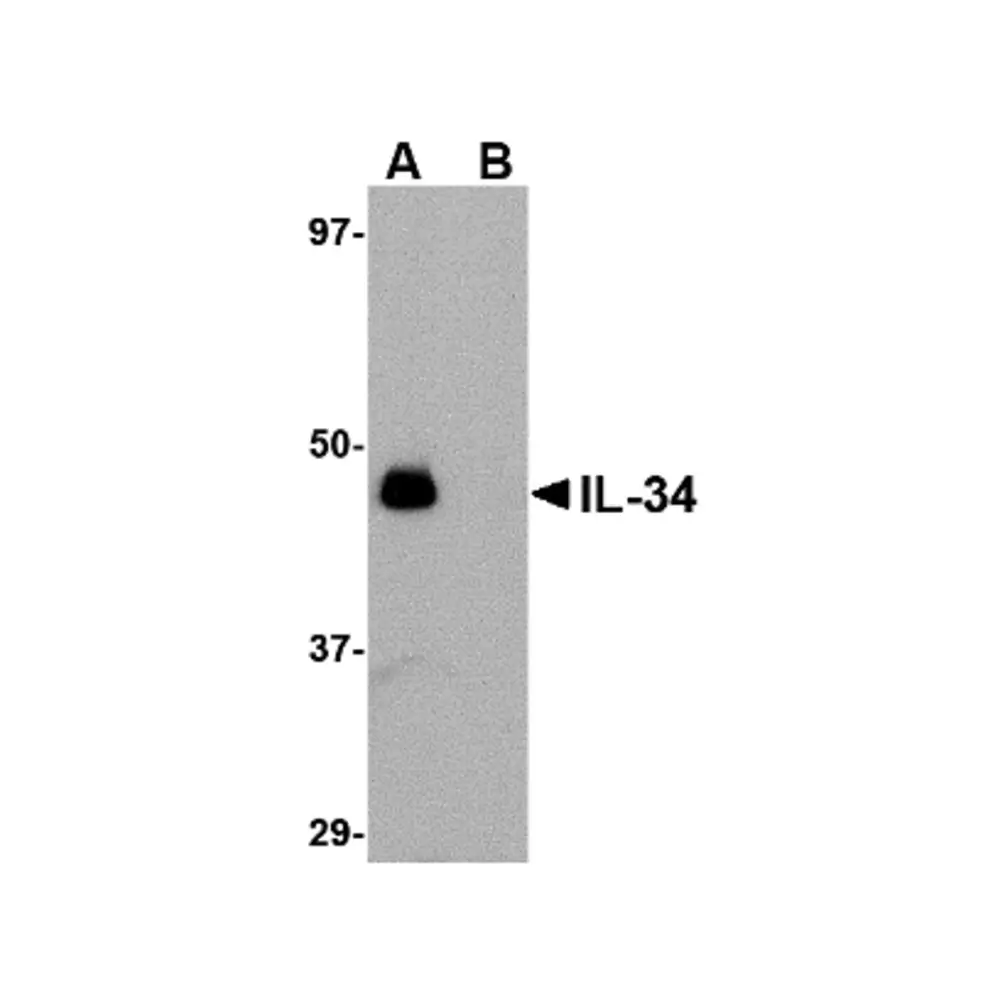ProSci 4779 IL-34 Antibody, ProSci, 0.1 mg/Unit Primary Image