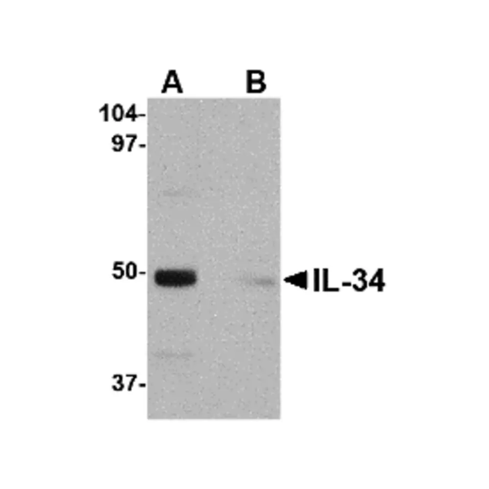 ProSci 4781_S IL-34 Antibody, ProSci, 0.02 mg/Unit Primary Image