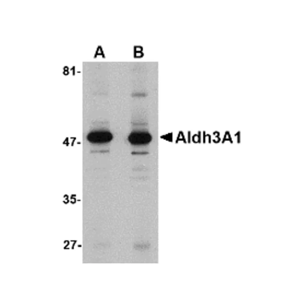 ProSci 4787_S Aldh3A1 Antibody, ProSci, 0.02 mg/Unit Primary Image