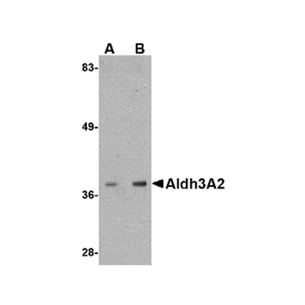 ProSci 4789_S Aldh3A2 Antibody, ProSci, 0.02 mg/Unit Primary Image