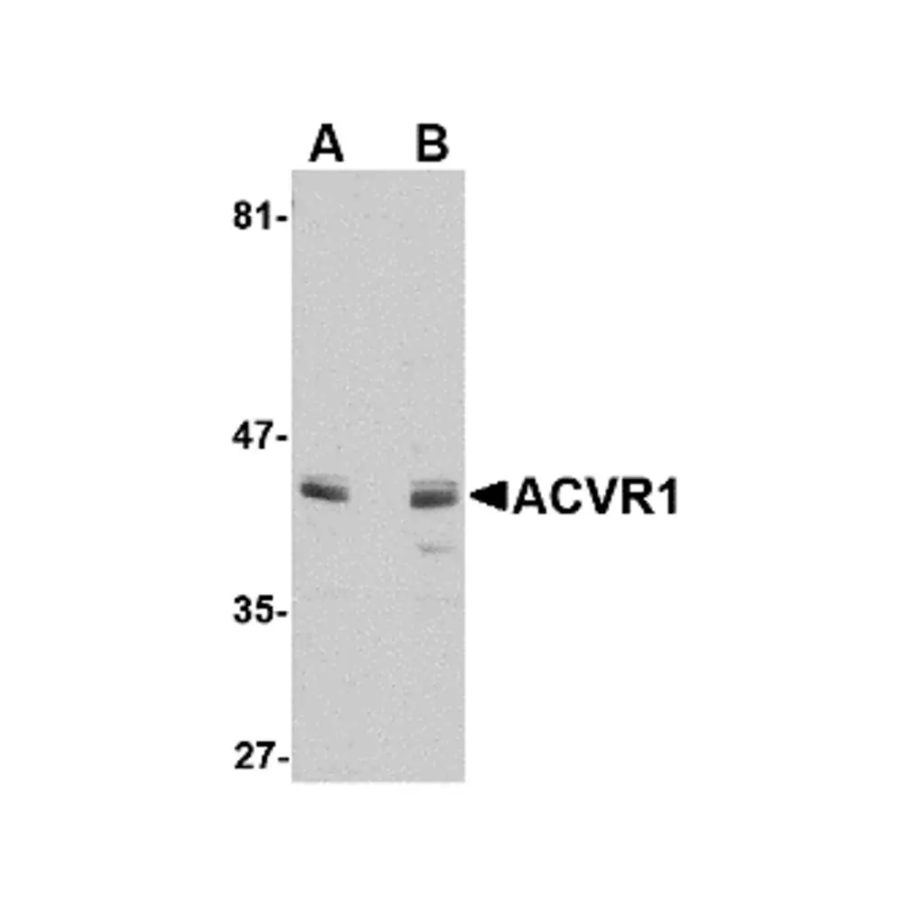 ProSci 4791 ACVR1 Antibody, ProSci, 0.1 mg/Unit Primary Image