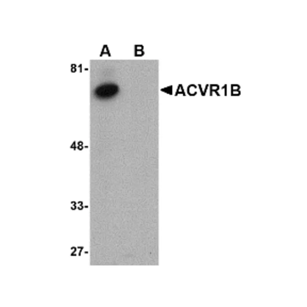 ProSci 4793_S ACVR1B Antibody, ProSci, 0.02 mg/Unit Primary Image