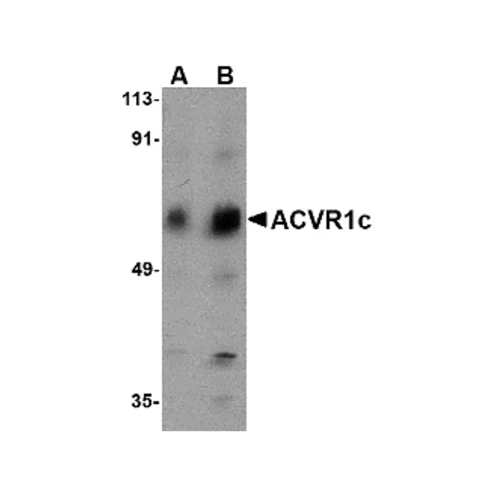 ProSci 4795_S ACVR1C Antibody, ProSci, 0.02 mg/Unit Primary Image