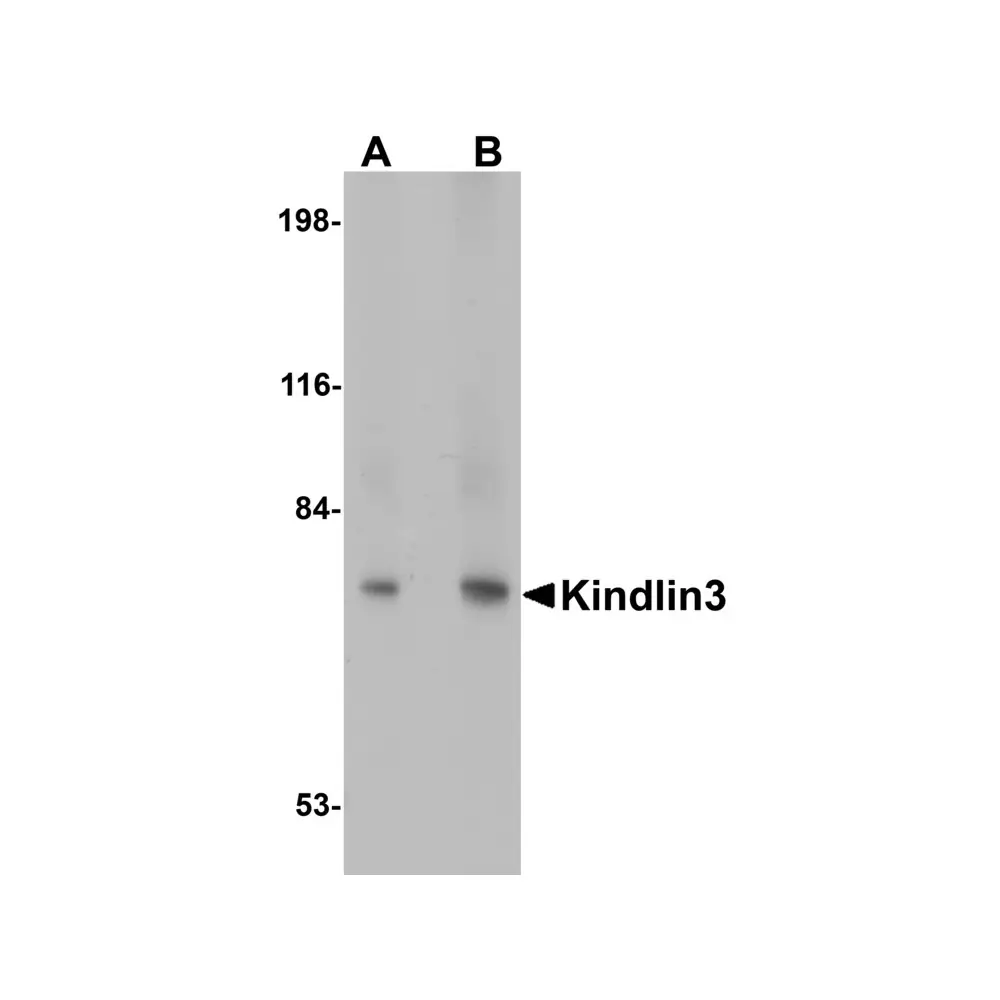 ProSci 4797_S KINDLIN3 Antibody, ProSci, 0.02 mg/Unit Primary Image