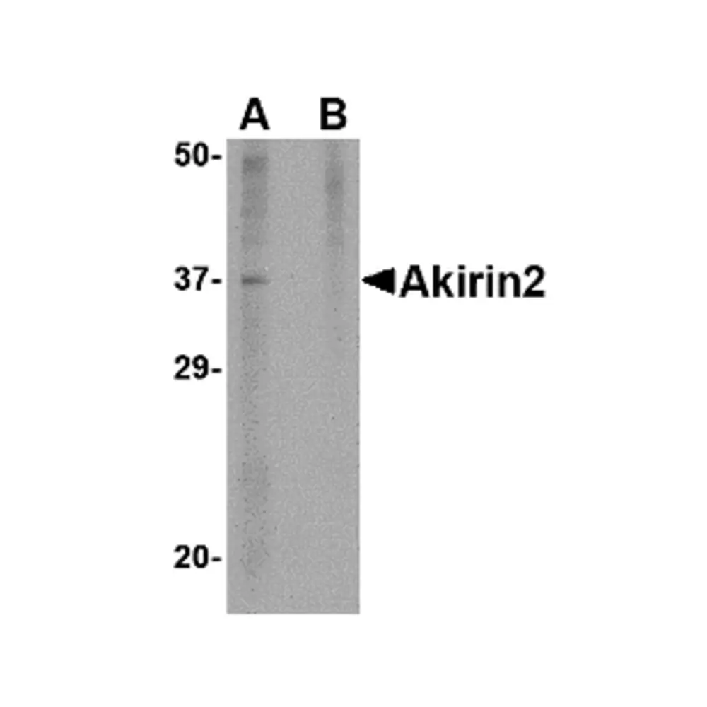 ProSci 4803_S Akirin2 Antibody, ProSci, 0.02 mg/Unit Primary Image