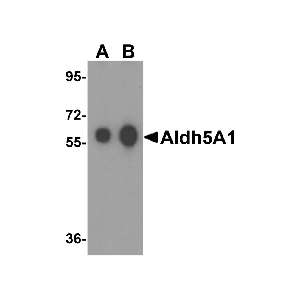 ProSci 4807 Aldh5A1 Antibody, ProSci, 0.1 mg/Unit Primary Image