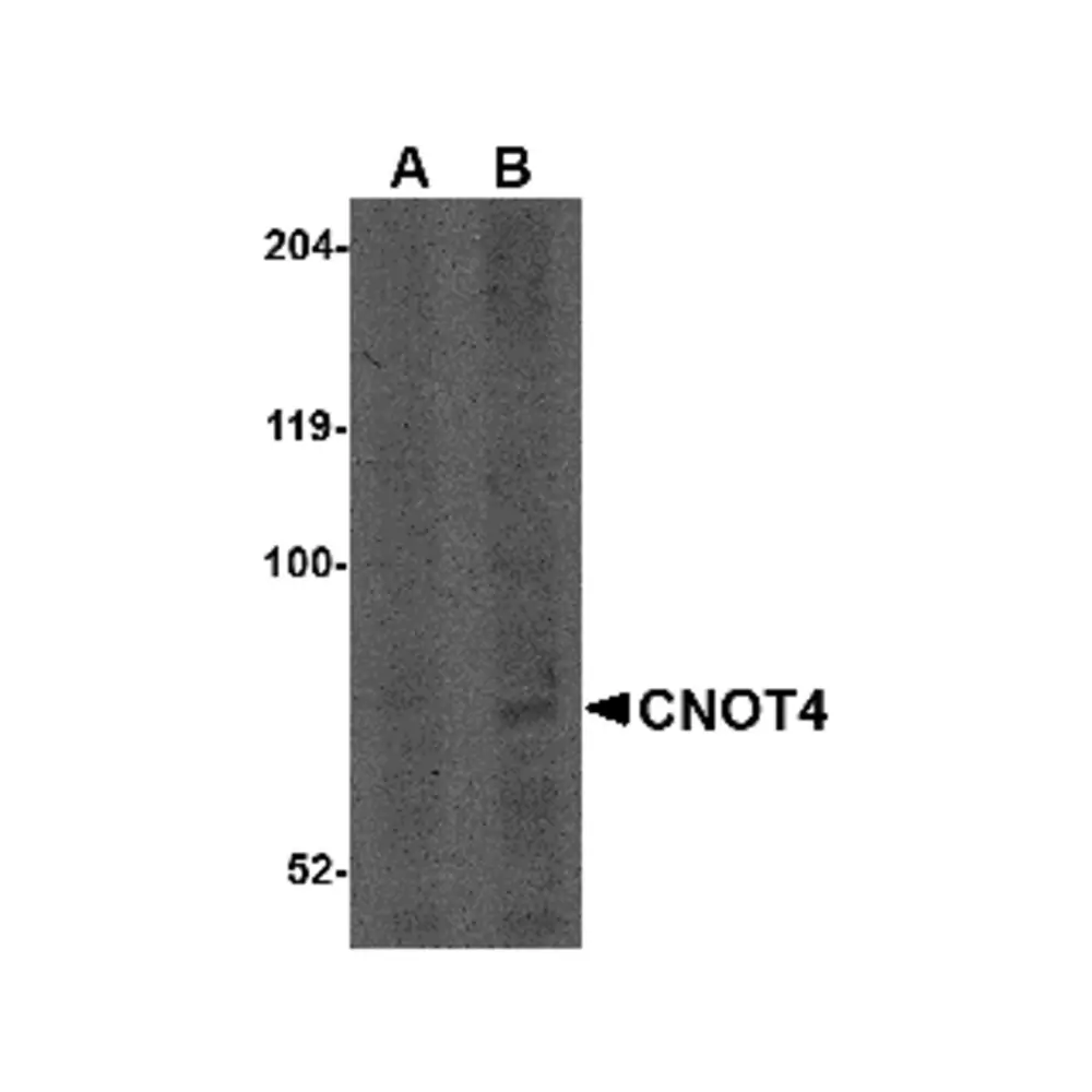 ProSci 4813_S CNOT4 Antibody, ProSci, 0.02 mg/Unit Primary Image