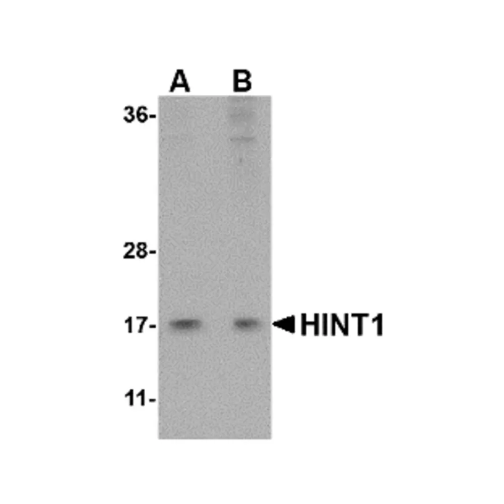 ProSci 4815_S HINT1 Antibody, ProSci, 0.02 mg/Unit Primary Image