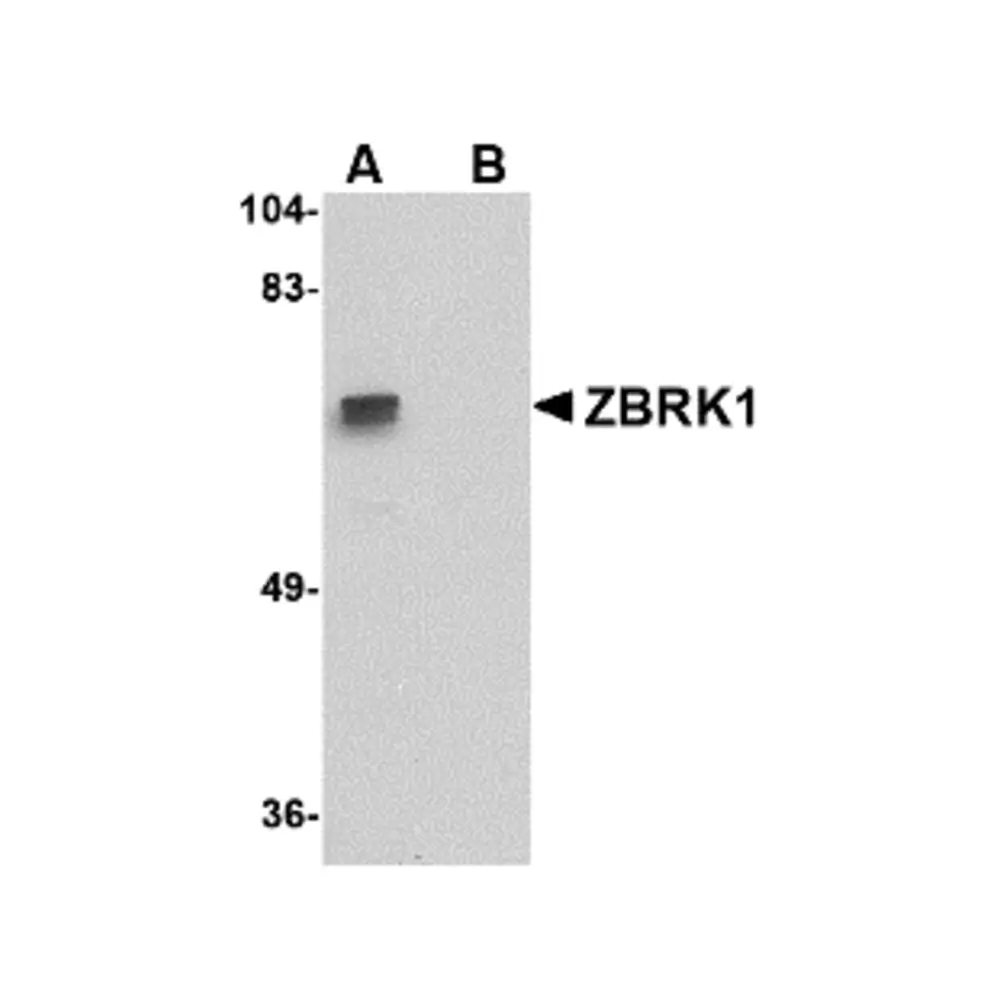 ProSci 4817_S ZBRK1 Antibody, ProSci, 0.02 mg/Unit Primary Image