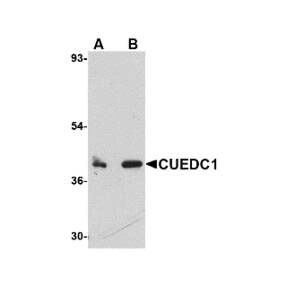 ProSci 4829_S CUEDC1 Antibody, ProSci, 0.02 mg/Unit Primary Image