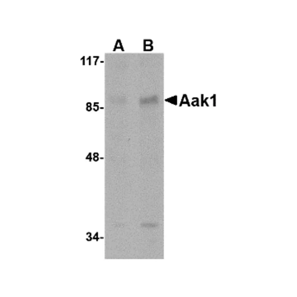 ProSci 4831 Aak1 Antibody, ProSci, 0.1 mg/Unit Primary Image