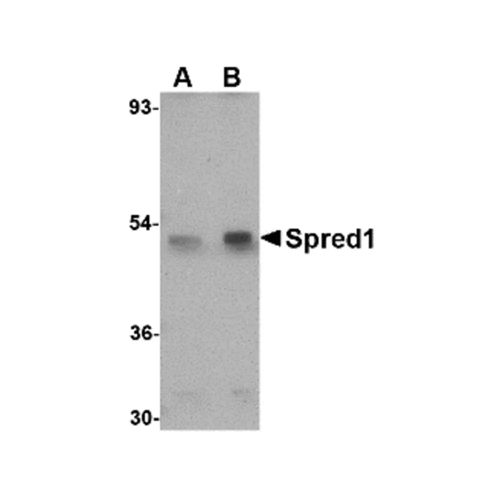 ProSci 4833_S Spred1 Antibody, ProSci, 0.02 mg/Unit Primary Image