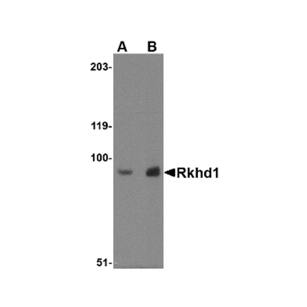 ProSci 4835 Rkhd1 Antibody, ProSci, 0.1 mg/Unit Primary Image