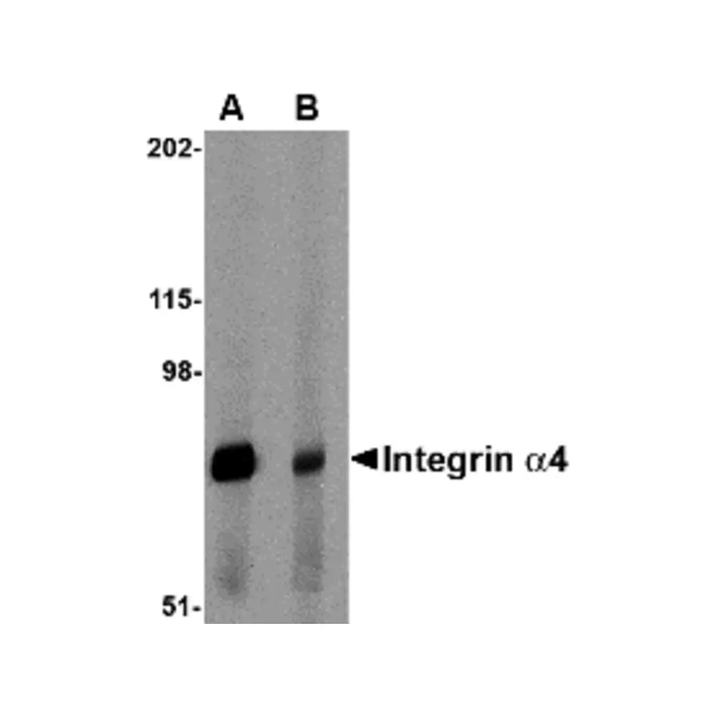 ProSci 4837 Integrin alpha 4 Antibody, ProSci, 0.1 mg/Unit Primary Image