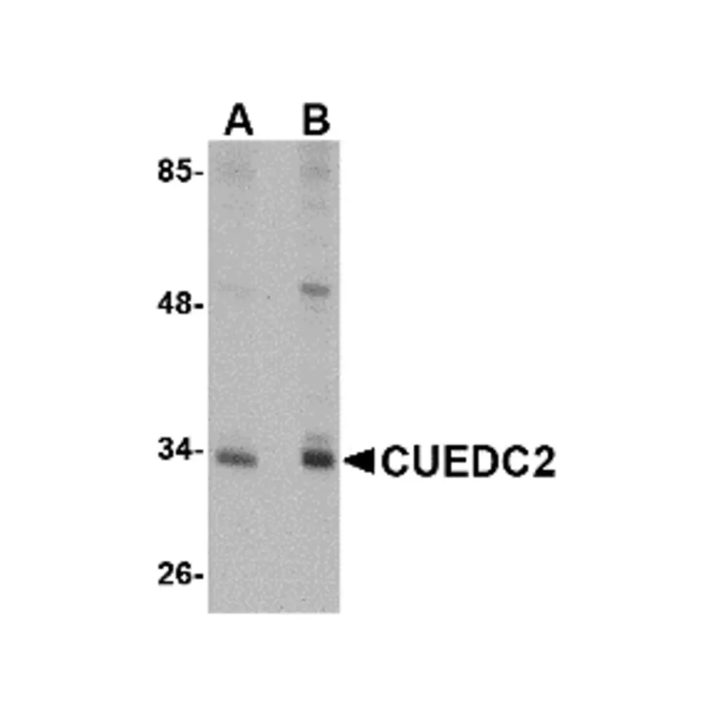 ProSci 4839 CUEDC2 Antibody, ProSci, 0.1 mg/Unit Primary Image