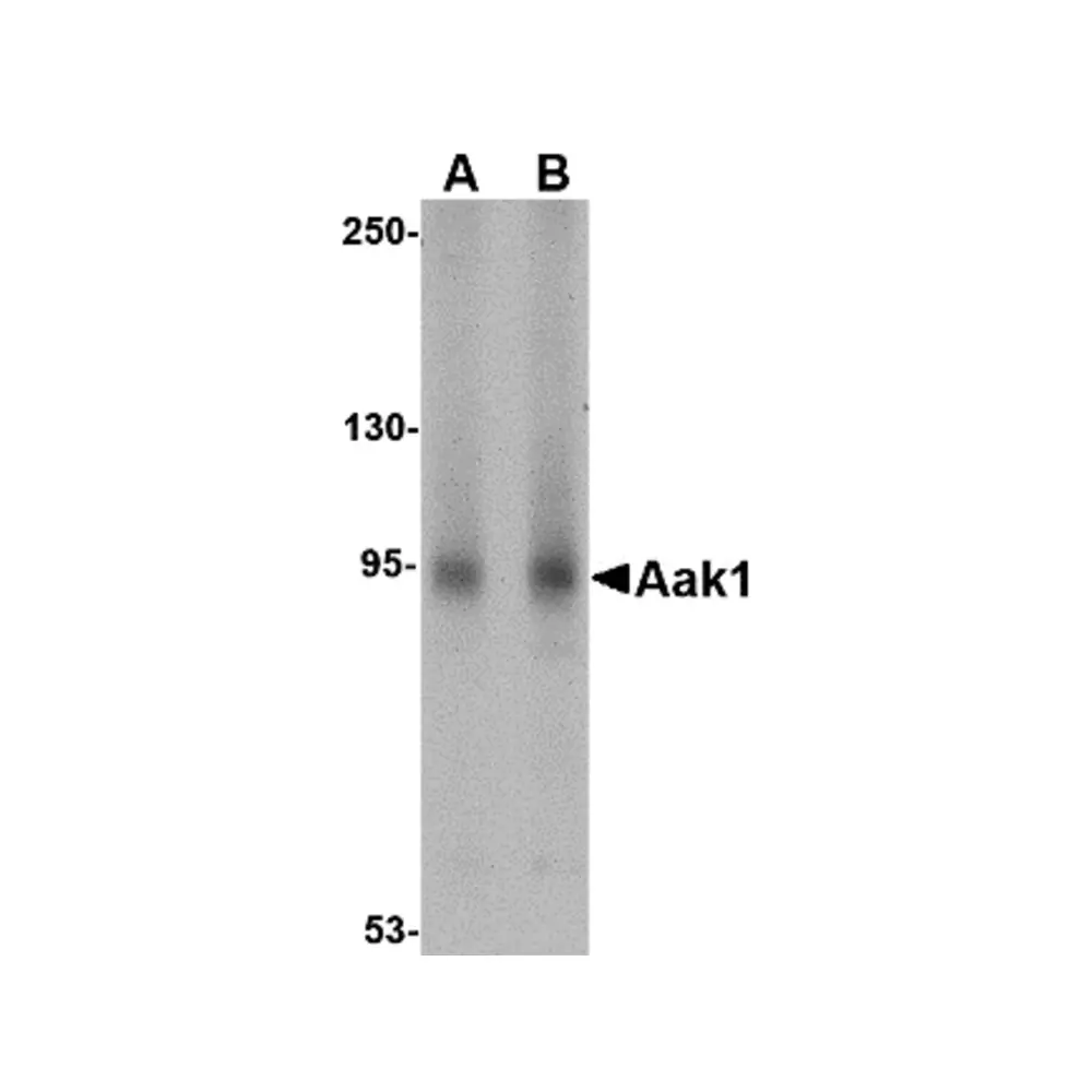 ProSci 4841 Aak1 Antibody, ProSci, 0.1 mg/Unit Primary Image