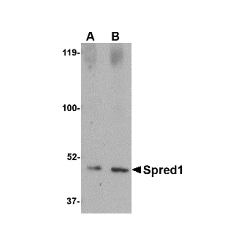 ProSci 4843_S Spred1 Antibody, ProSci, 0.02 mg/Unit Primary Image