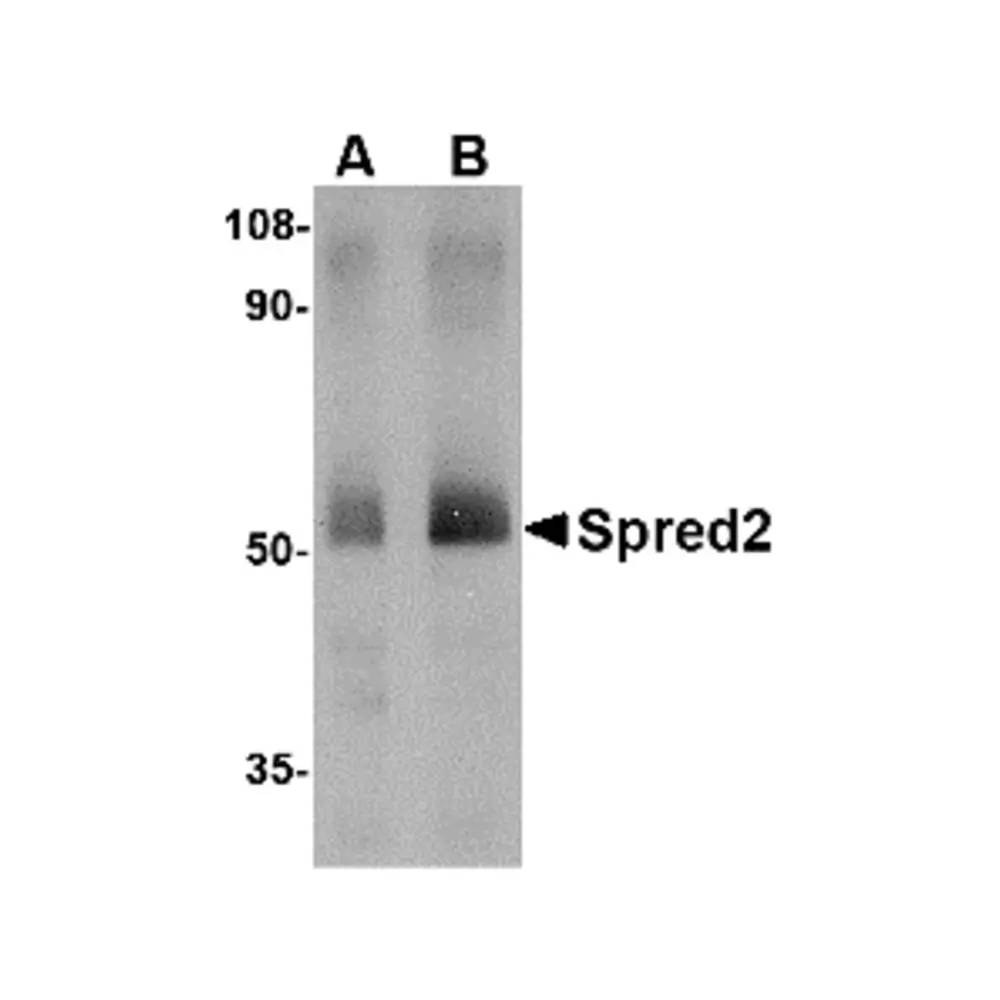ProSci 4849 Spred2 Antibody, ProSci, 0.1 mg/Unit Primary Image