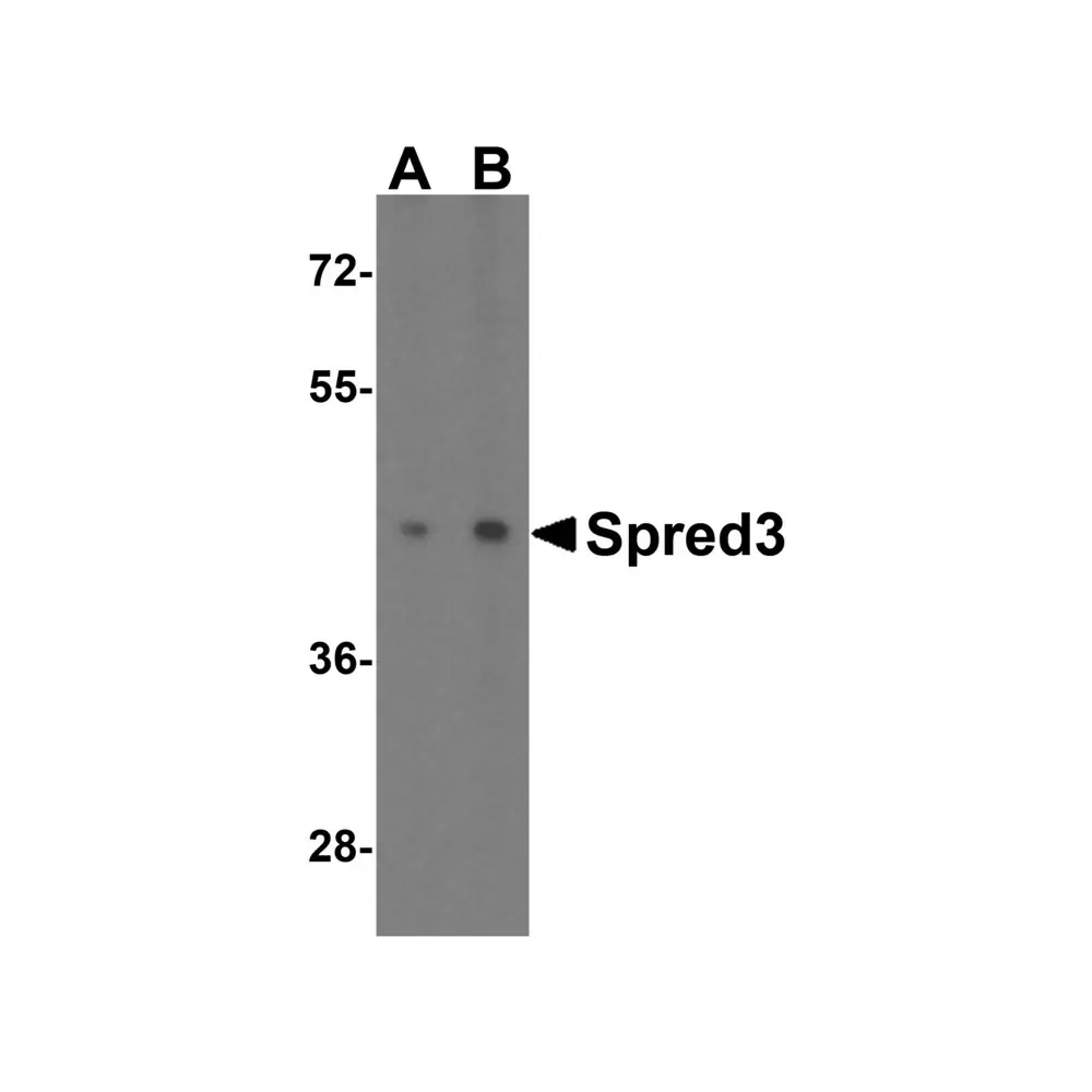 ProSci 4851_S Spred3 Antibody, ProSci, 0.02 mg/Unit Primary Image