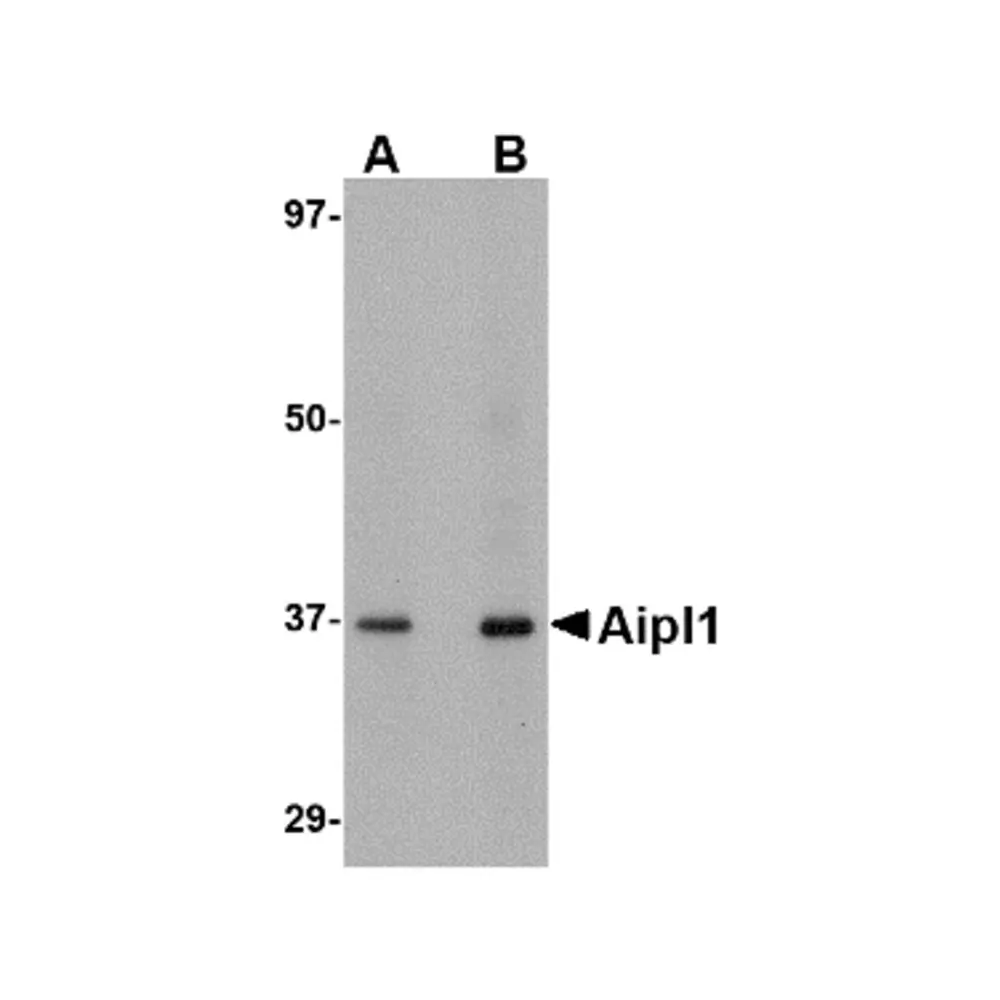 ProSci 4853 Aipl1 Antibody, ProSci, 0.1 mg/Unit Primary Image