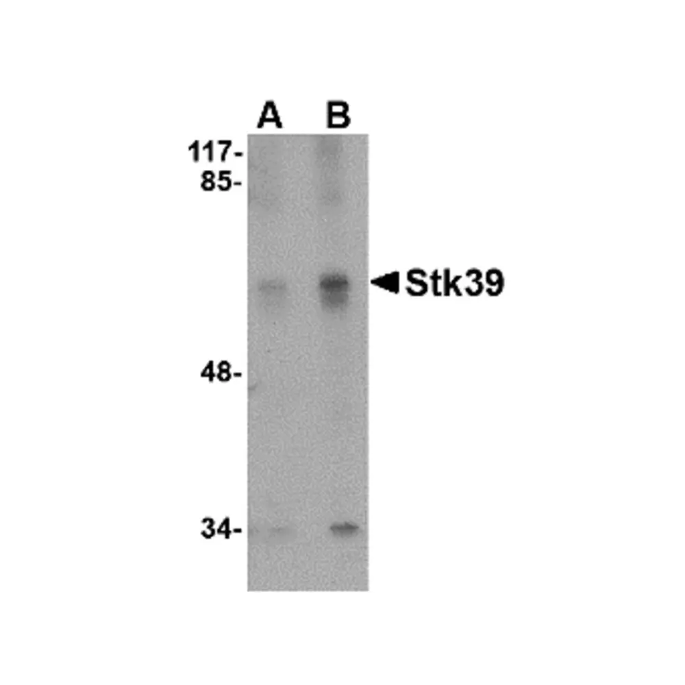 ProSci 4855 Stk39 Antibody, ProSci, 0.1 mg/Unit Primary Image