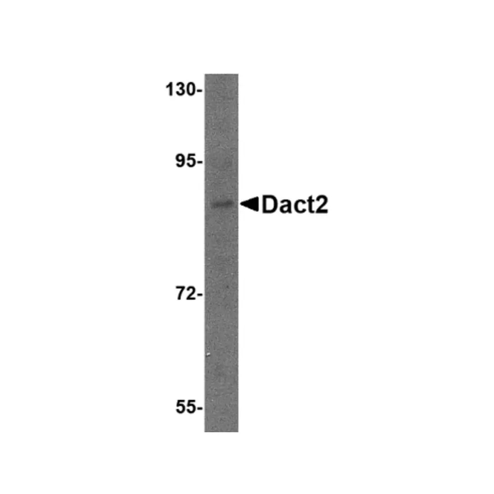 ProSci 4859 Dact2 Antibody, ProSci, 0.1 mg/Unit Primary Image