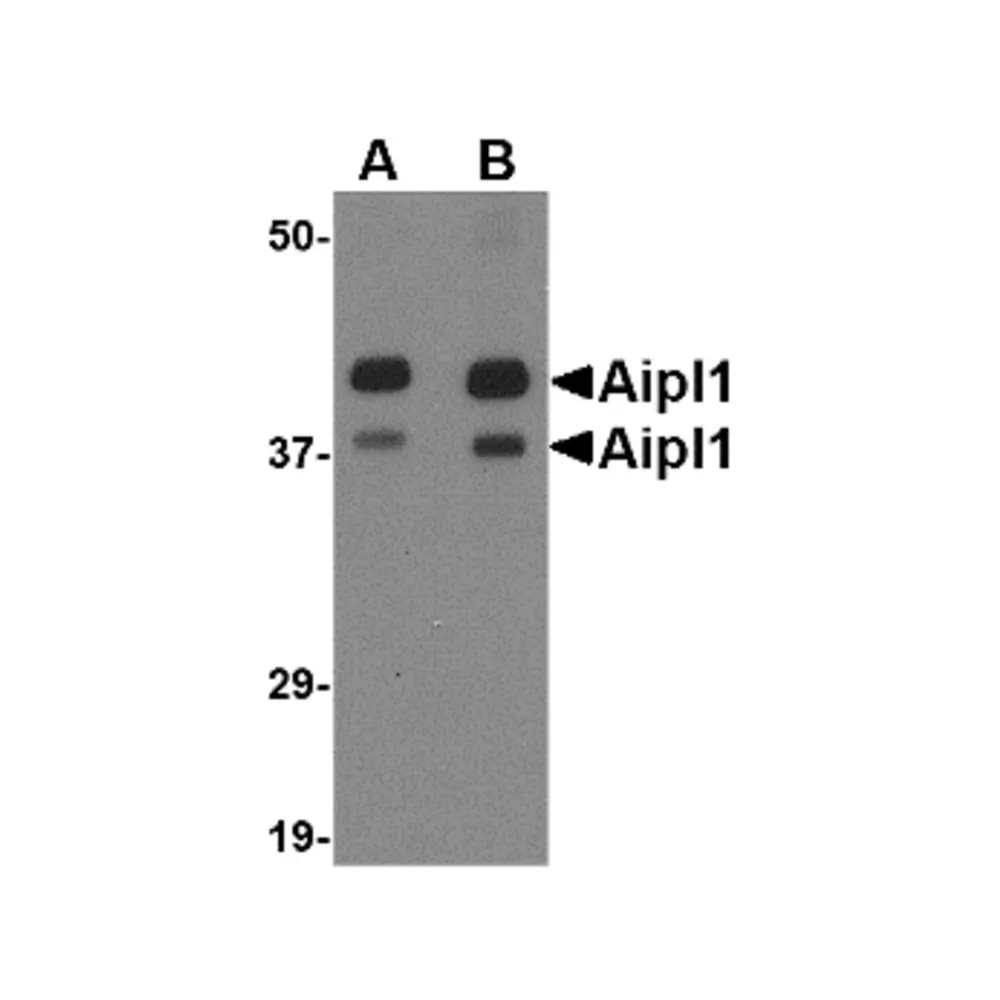 ProSci 4865 Aipl1 Antibody, ProSci, 0.1 mg/Unit Primary Image