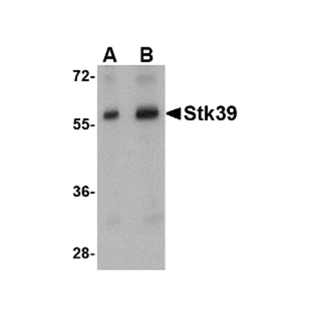 ProSci 4867_S Stk39 Antibody, ProSci, 0.02 mg/Unit Primary Image
