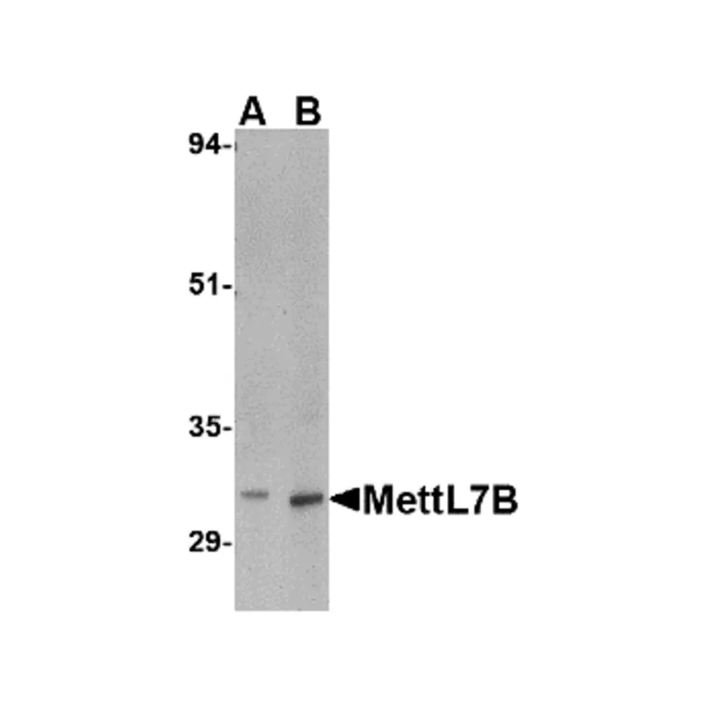 ProSci 4881 MettL7B Antibody, ProSci, 0.1 mg/Unit Primary Image