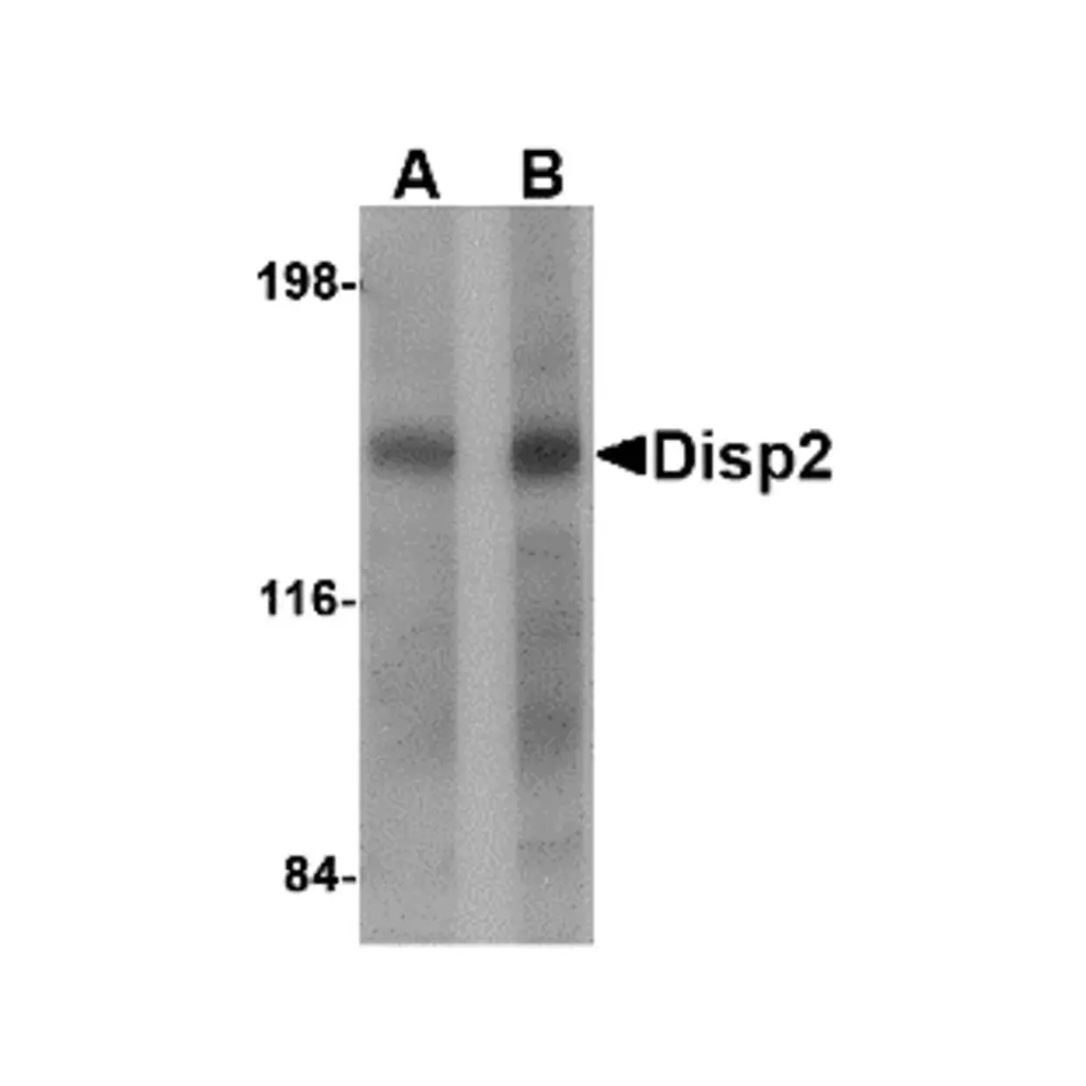 ProSci 4883 Disp2 Antibody, ProSci, 0.1 mg/Unit Primary Image